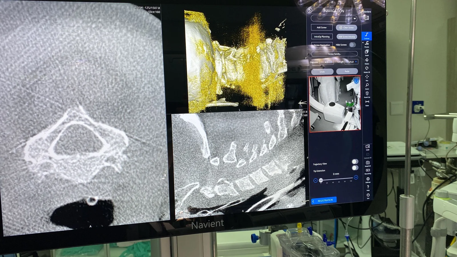 Artificial Intelligence in Neurosurgery: The Rise of Intelligent Surgical Planning