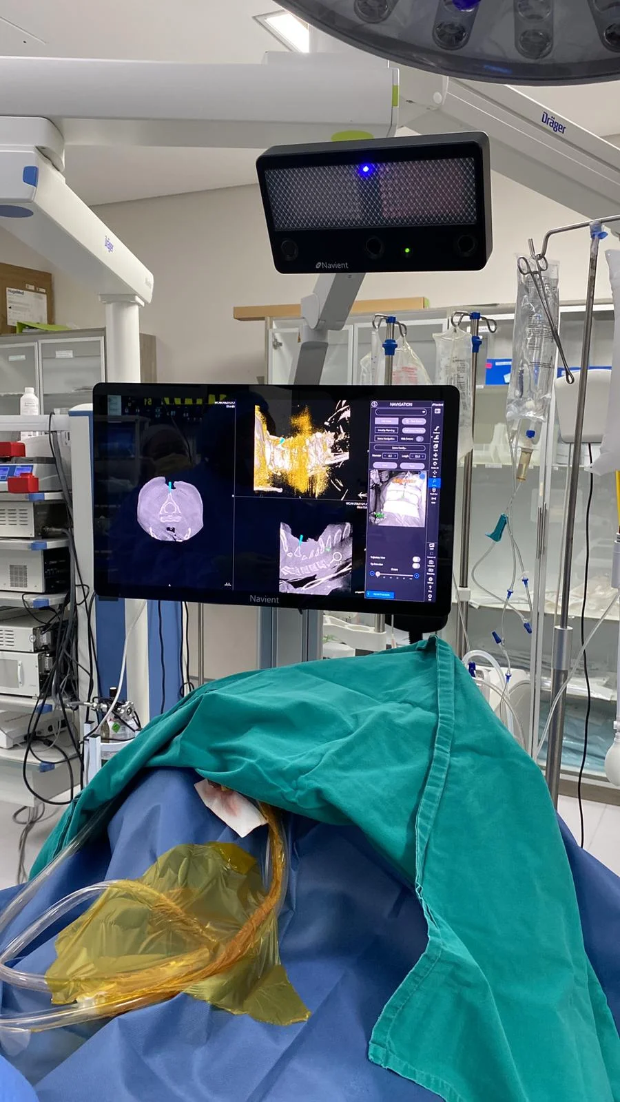 NAVIENT Complete System